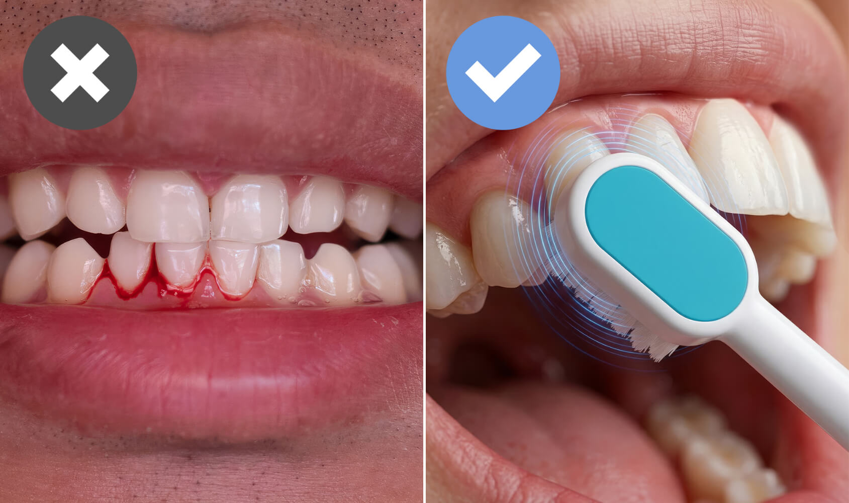 Your Toothbrush, of All Things, Could Be Quietly Damaging Your Gums (Here's What You Need To Do...)