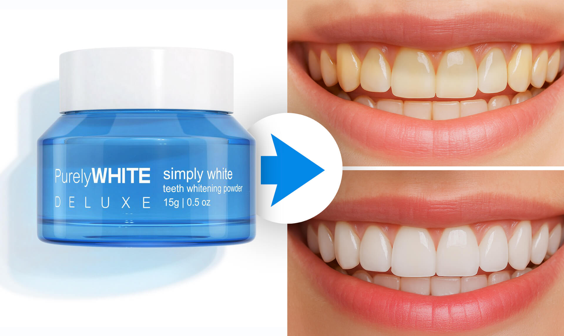 After years of hiding their smile, over 1 million people found the whitening trick that finally worked